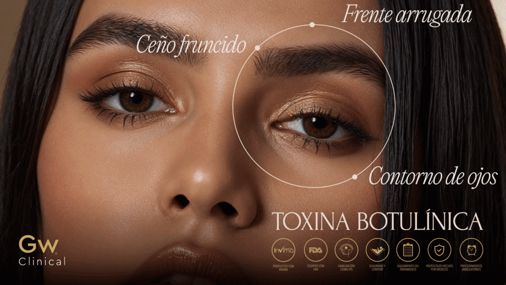 "botulínica toxina toxina botulínica botulínica toxina tiroxina libre toxina botulínica precio toxina botulínica para que sirve toxina botulínica botox toxina botulínica precio colombia toxina botulínica marcas toxina botulínica que es botox capilar botox antes y despues botox bogota botox capilar ampolla botox toxina botulinica botox frasco"